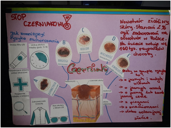 Czerniak 1
