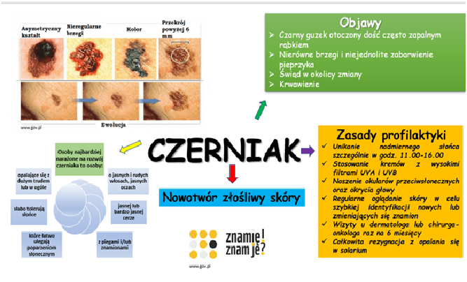Czerniak 2